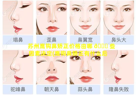 苏州鹰钩鼻矫正价格由哪 🐋 些因素决定(鹰钩鼻矫正有什么后 🐱 遗症)